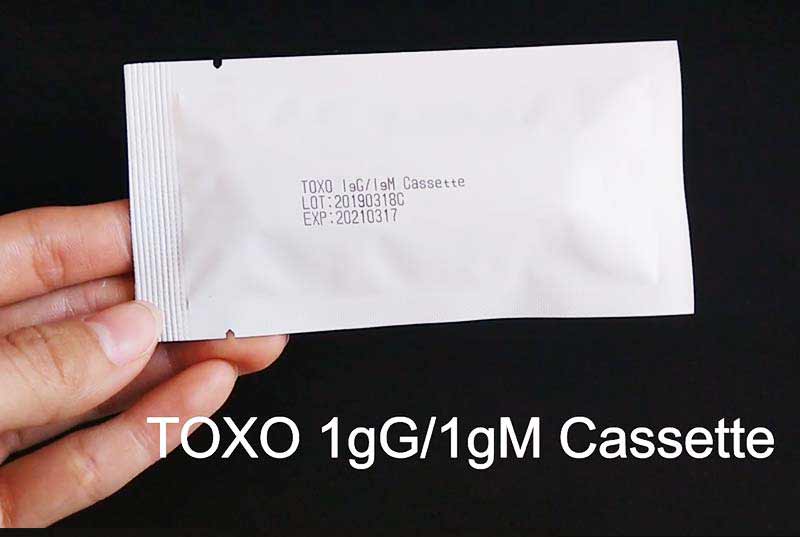 toxoplasmosis-blood-test